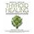 Medical Medium Thyroid Healing: The Truth behind Hashimoto\'s, Graves\', Insomnia, Hypothyroidism, Thyroid Nodules Epstein-Barr